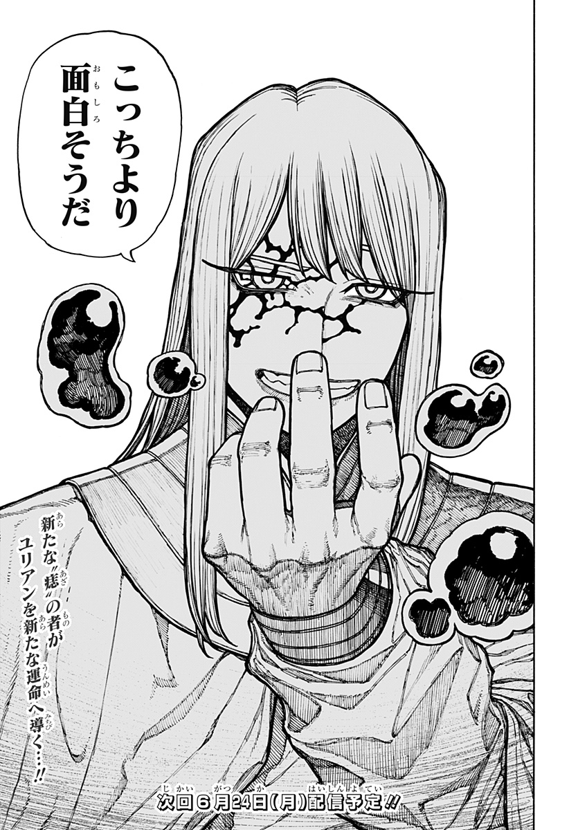 25