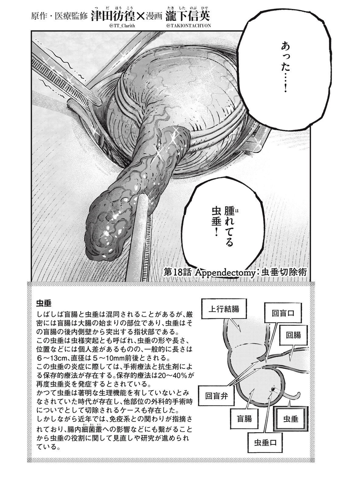 KOUDO NI HATTATSU SHITA IGAKU WA MAHOU TO KUBETSU GA TSUKANAI - raw - Chapter 18.1 - https://jpdd.ccdd.to/JPDD/koudonihattatsushitaigakuwamahoutokubetsugatsukanai/271602/h05fdlacjr4.jpg