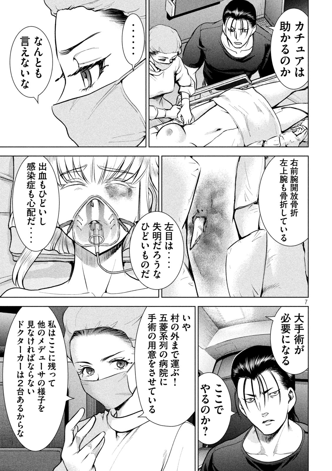 7